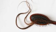 Was ist Alopezie areata Was ist Alopezie areata
