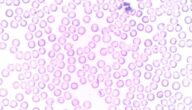 Was ist die Funktion von Leukozyten Was bedeutet ein Anstieg der Erythrozyten