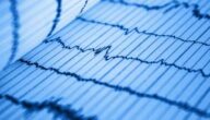 Was ist ein Elektrokardiogramm Was ist ein Elektrokardiogramm