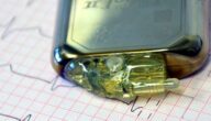 Elektrokardiogramm-Symptome Ursachen für Herzstillstand