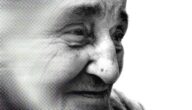 Symptome des Auftretens von Alzheimer Ursachen der SLE-Krankheit