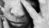 Ursachen der Vitiligo-Krankheit Arten von Vitiligo