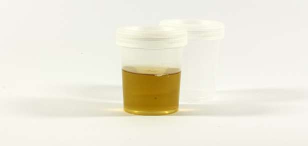 Virale Entzündung des Rachens Virale Entzündung des Rachens