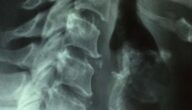 Wie man Beschwerden diagnostiziert Wie man Beschwerden diagnostiziert